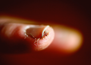 Toe Dream: What Does It Mean? Learn the Common Interpretations