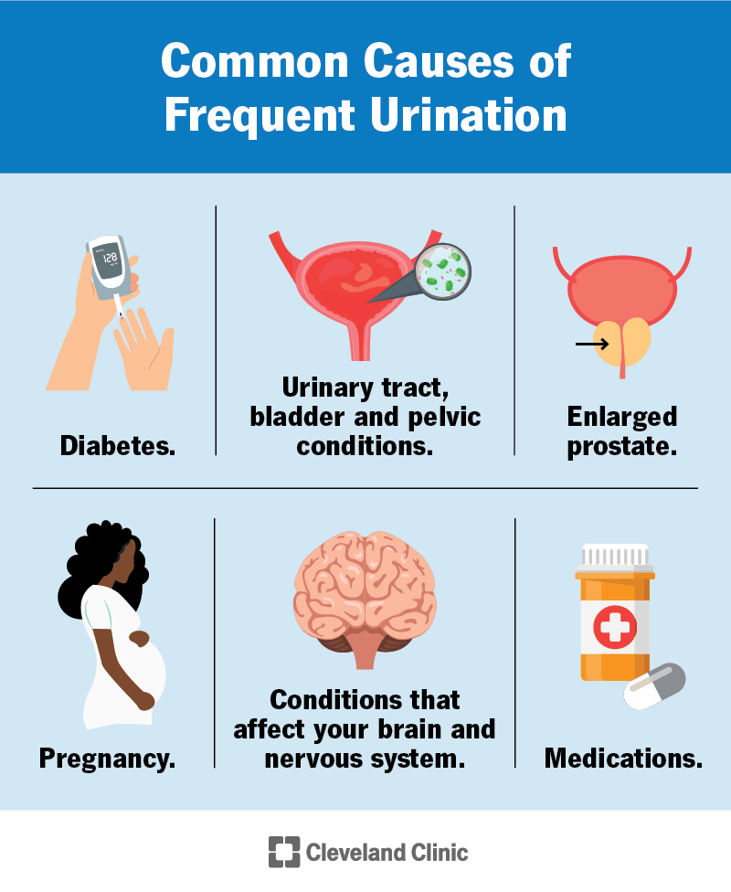 Why Do I Keep Having a Dream of Urinating? Causes and Solutions.